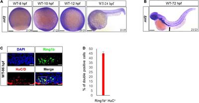 The Polycomb group gene rnf2 is essential for central and enteric neural system development in zebrafish